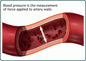 High Blood Pressure