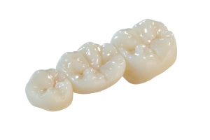 Why should we choose zirconia crowns?